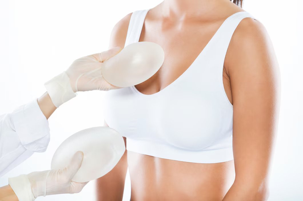 Mamoplastia de Aumento: Proporção e Confiança