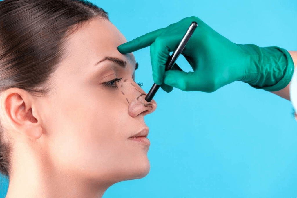 Rinoplastia: Harmonizando o Rosto