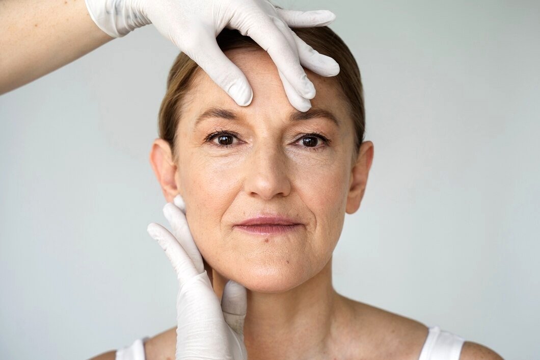 Lifting Facial: Técnicas para Rejuvenescimento