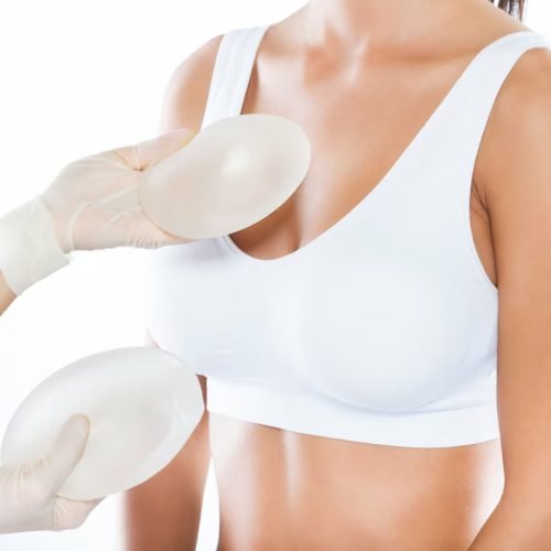 Mamoplastia de Aumento: Proporção e Confiança